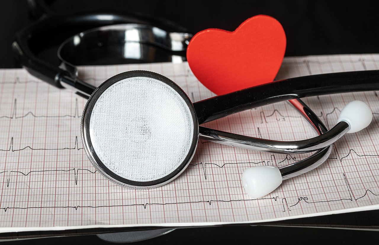 Stethoscope and heart on an EKG report