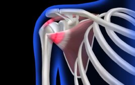 An image depicting shoulder pain